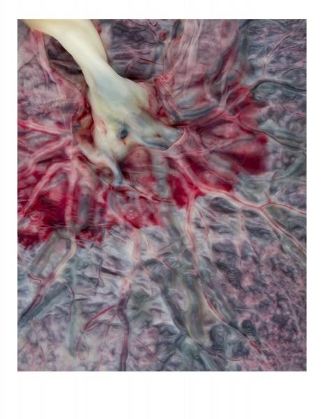 A close-up of a placenta with branching vessels in vivid hues and an umbilical cord illustrates human anatomy in "Hidden Beauty: Exploring the Aesthetics of Medical Science" by Schiffer Publishing, Ltd.