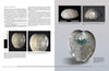 echinoid fossil identification