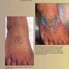 A photo from "Ink in the Hood" by Schiffer Publishing, Ltd. shows a faded butterfly tattoo on a foot and a vibrant cover-up, highlighting tattoo techniques and visibility issues for people of color.
